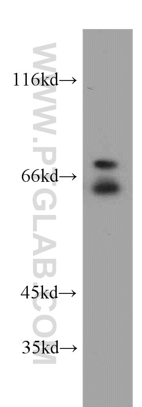 Western Blot (WB) analysis of HEK-293 cells using NF2 Polyclonal antibody (21686-1-AP)