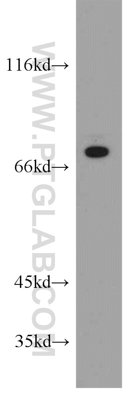 Western Blot (WB) analysis of Jurkat cells using NF2 Polyclonal antibody (21686-1-AP)