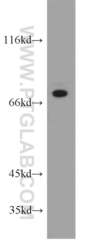 WB analysis of Jurkat using 21686-1-AP
