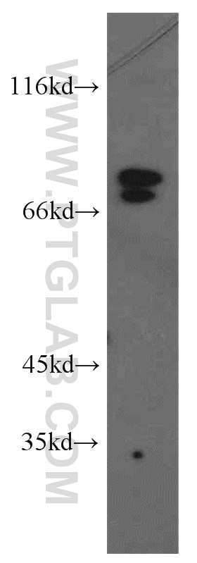 WB analysis of SH-SY5Y using 21686-1-AP