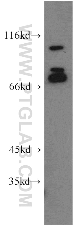 Western Blot (WB) analysis of NIH/3T3 cells using NF2 Polyclonal antibody (21686-1-AP)