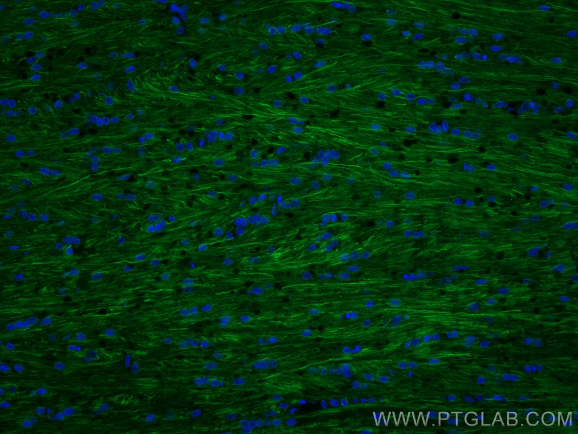 Immunofluorescence (IF) / fluorescent staining of rat brain tissue using NF-H/NF200 Monoclonal antibody (60331-1-Ig)