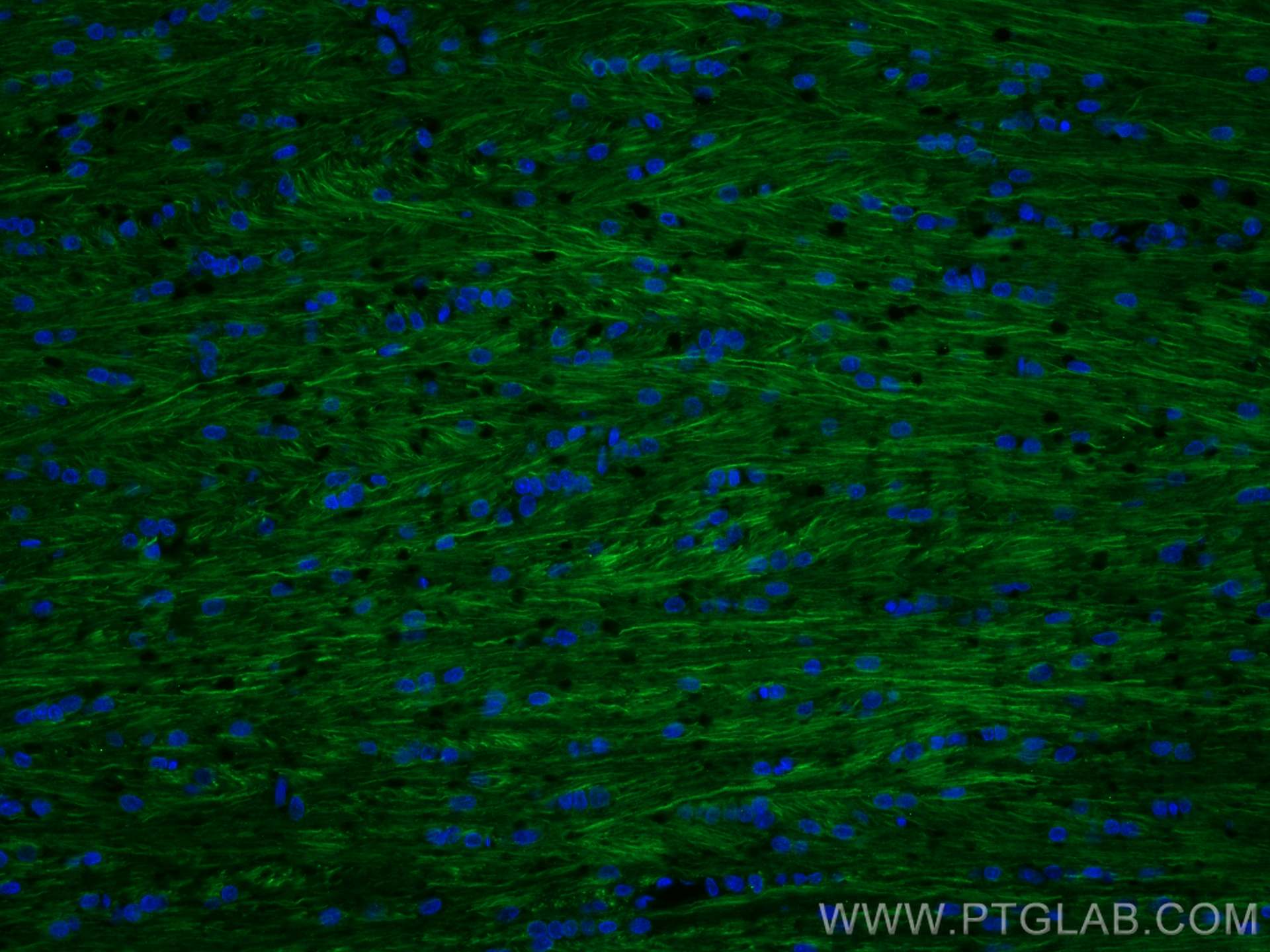 IF Staining of rat brain using 60331-1-Ig