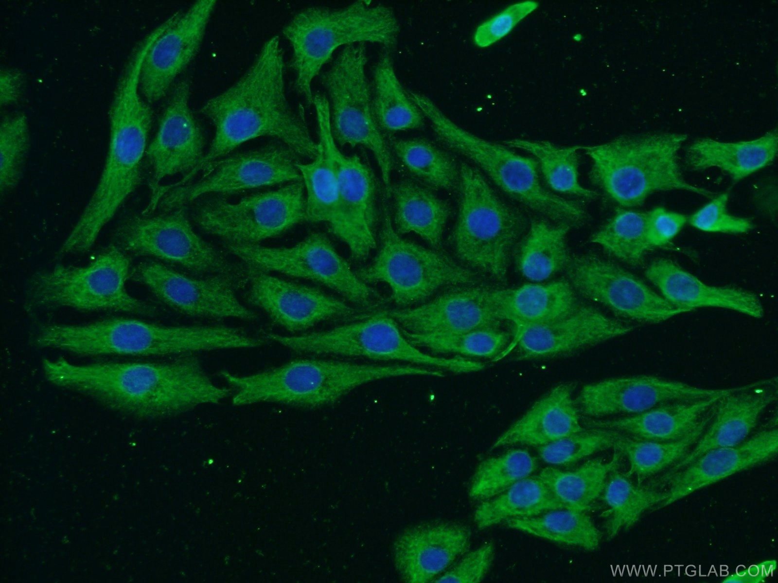 Immunofluorescence (IF) / fluorescent staining of SH-SY5Y cells using NF-H/NF200 Monoclonal antibody (60331-1-Ig)
