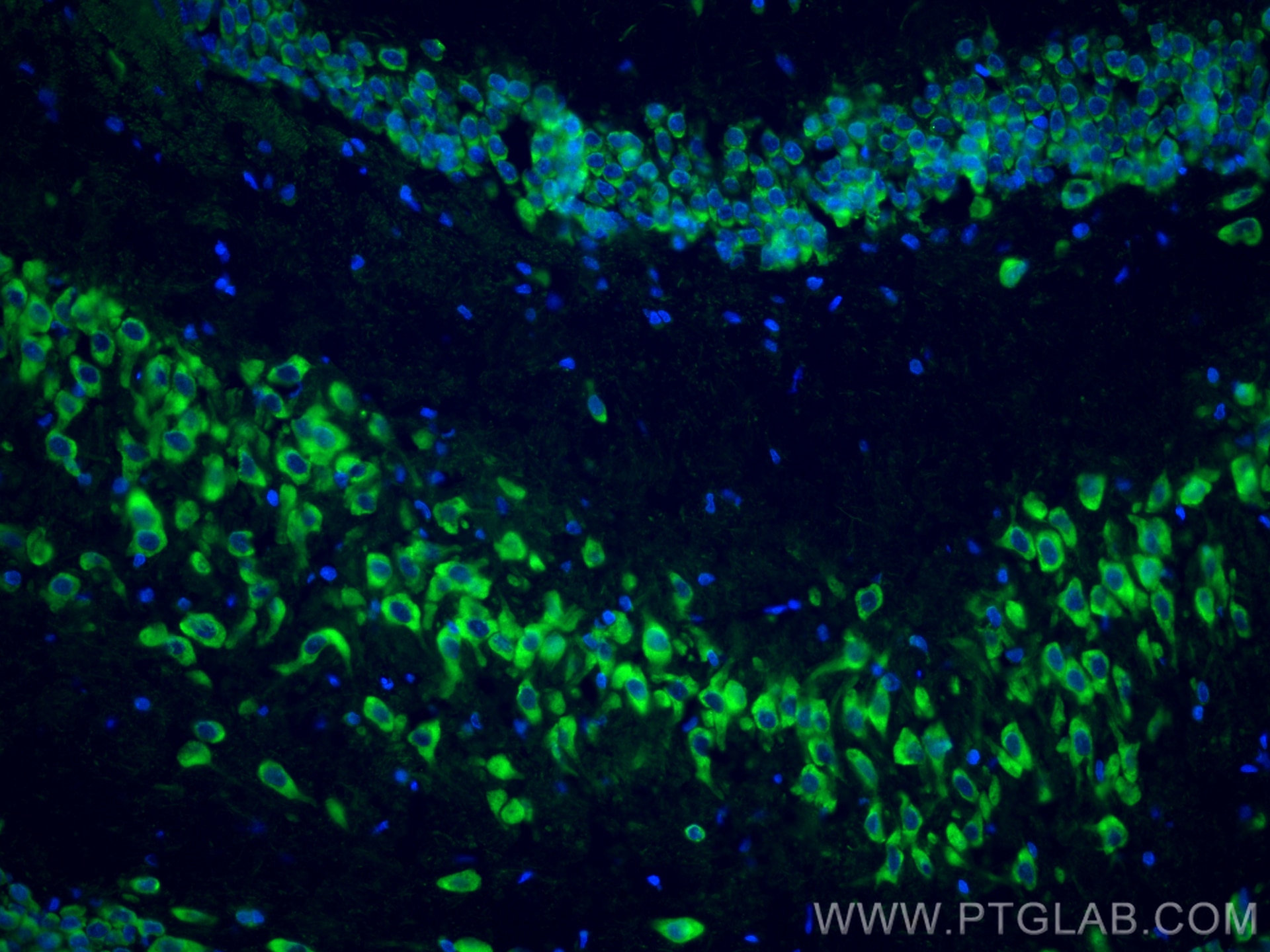 Immunofluorescence (IF) / fluorescent staining of rat brain tissue using NF-H/NF200 Monoclonal antibody (60331-1-Ig)
