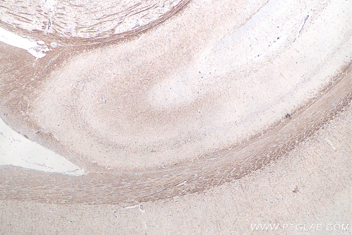 IHC staining of rat brain using 60331-1-Ig Immunohistochemistry (IHC) staining of rat brain tissue using NF-H/NF200 Monoclonal antibody (60331-1-Ig)