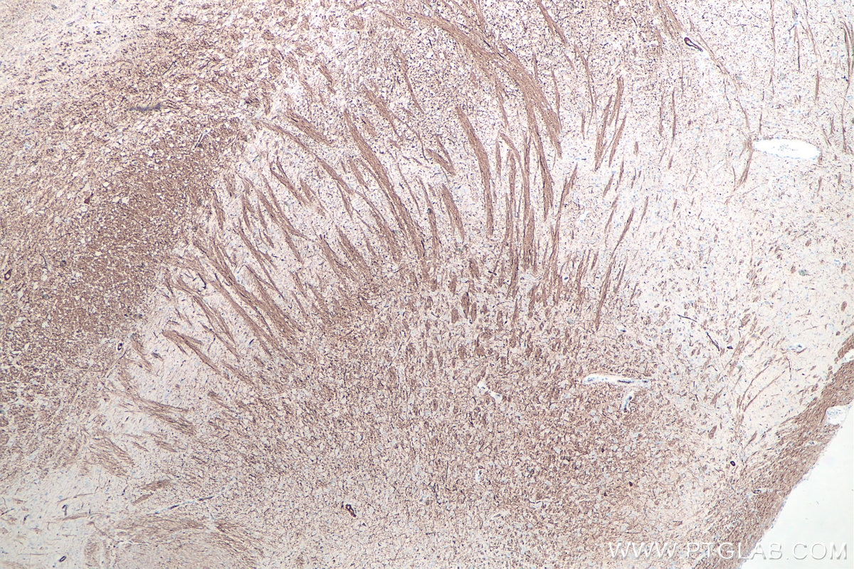 IHC staining of rat brain using 60331-1-Ig Immunohistochemistry (IHC) staining of rat brain tissue using NF-H/NF200 Monoclonal antibody (60331-1-Ig)