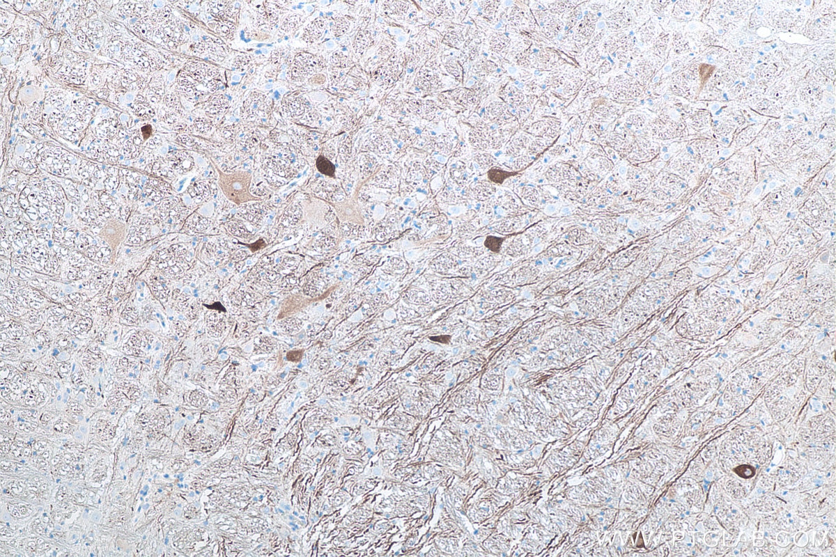 Immunohistochemistry (IHC) staining of rat cerebellum tissue using NF-H/NF200 Monoclonal antibody (60331-1-Ig)