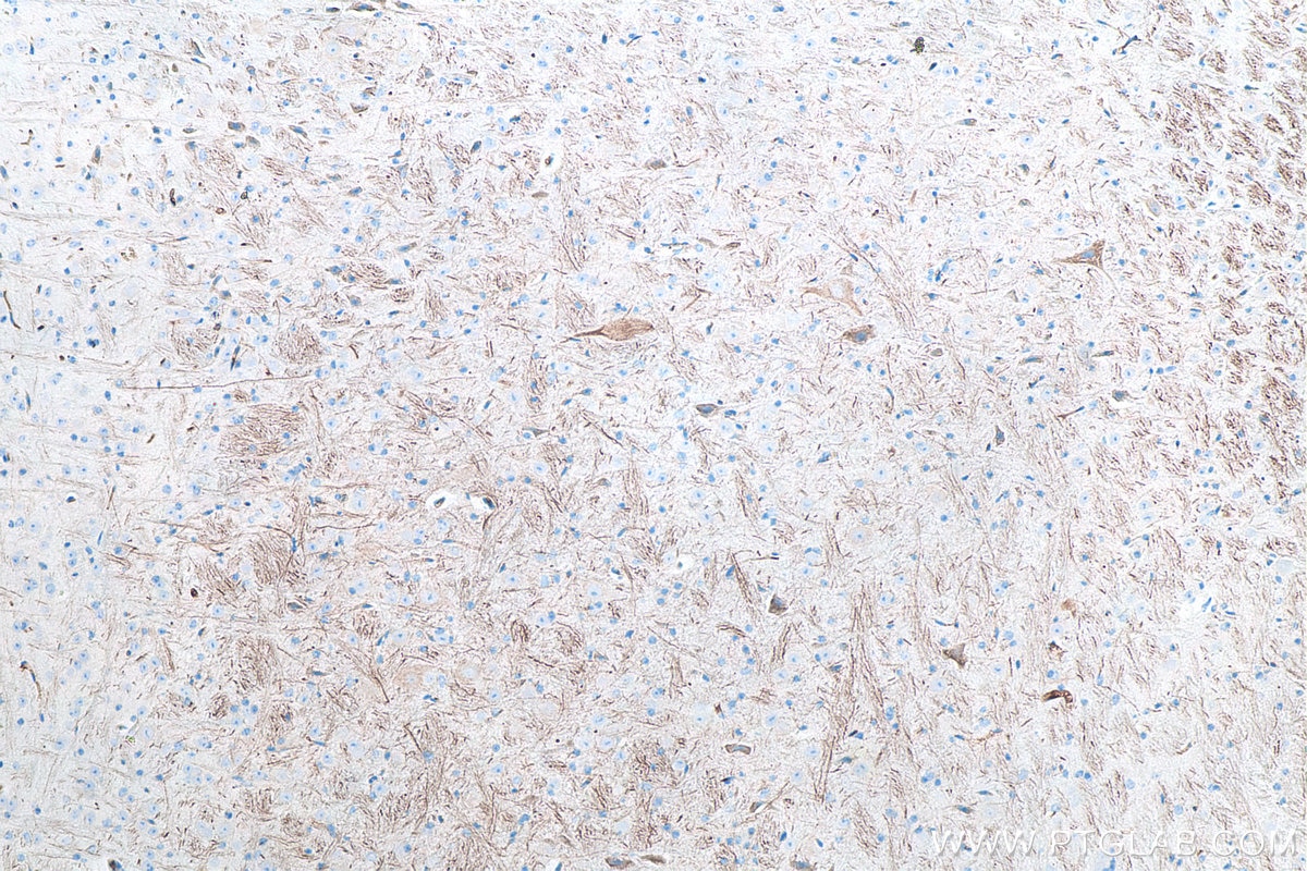 IHC staining of mouse cerebellum using 60331-1-Ig Immunohistochemistry (IHC) staining of mouse cerebellum tissue using NF-H/NF200 Monoclonal antibody (60331-1-Ig)