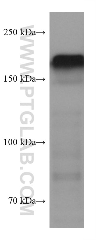 Western Blot (WB) analysis of rat brain tissue using NF-H/NF200 Monoclonal antibody (60331-1-Ig)