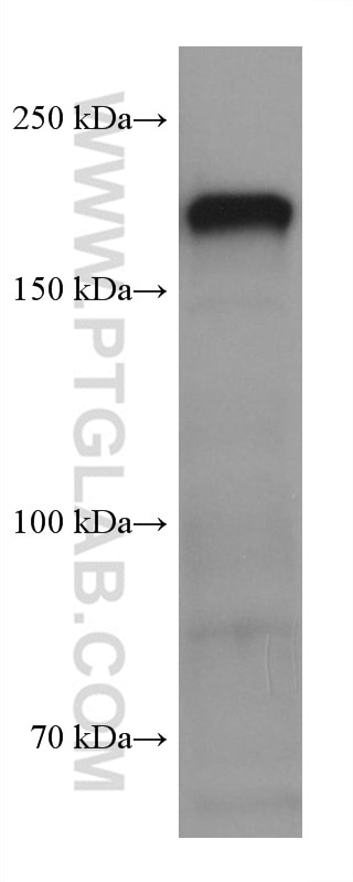 WB analysis of mouse brain using 60331-1-Ig