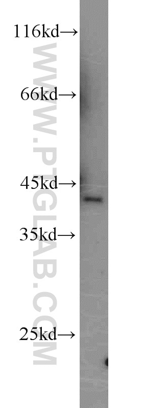 WB analysis of mouse brain using 14714-1-AP