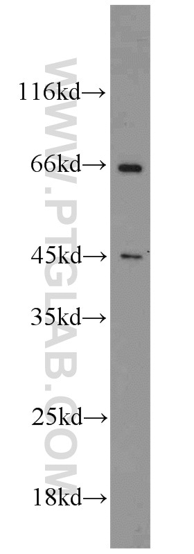 Western Blot (WB) analysis of NIH/3T3 cells using NF45 Polyclonal antibody (14714-1-AP)