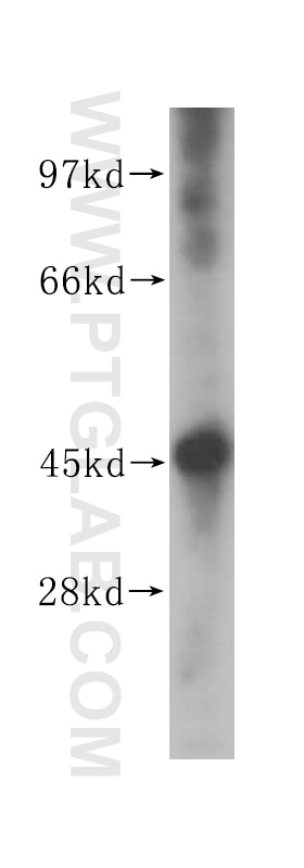 Western Blot (WB) analysis of K-562 cells using NF45 Polyclonal antibody (14714-1-AP)