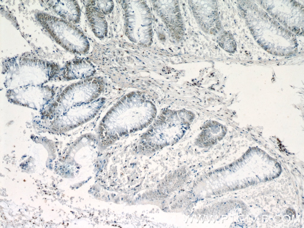 Immunohistochemistry (IHC) staining of human colon tissue using NF45 Polyclonal antibody (24572-1-AP)
