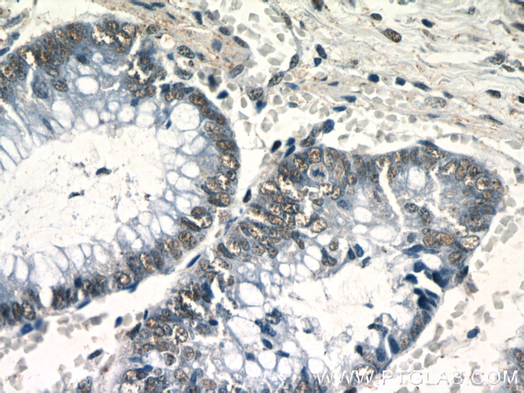 Immunohistochemistry (IHC) staining of human colon tissue using NF45 Polyclonal antibody (24572-1-AP)