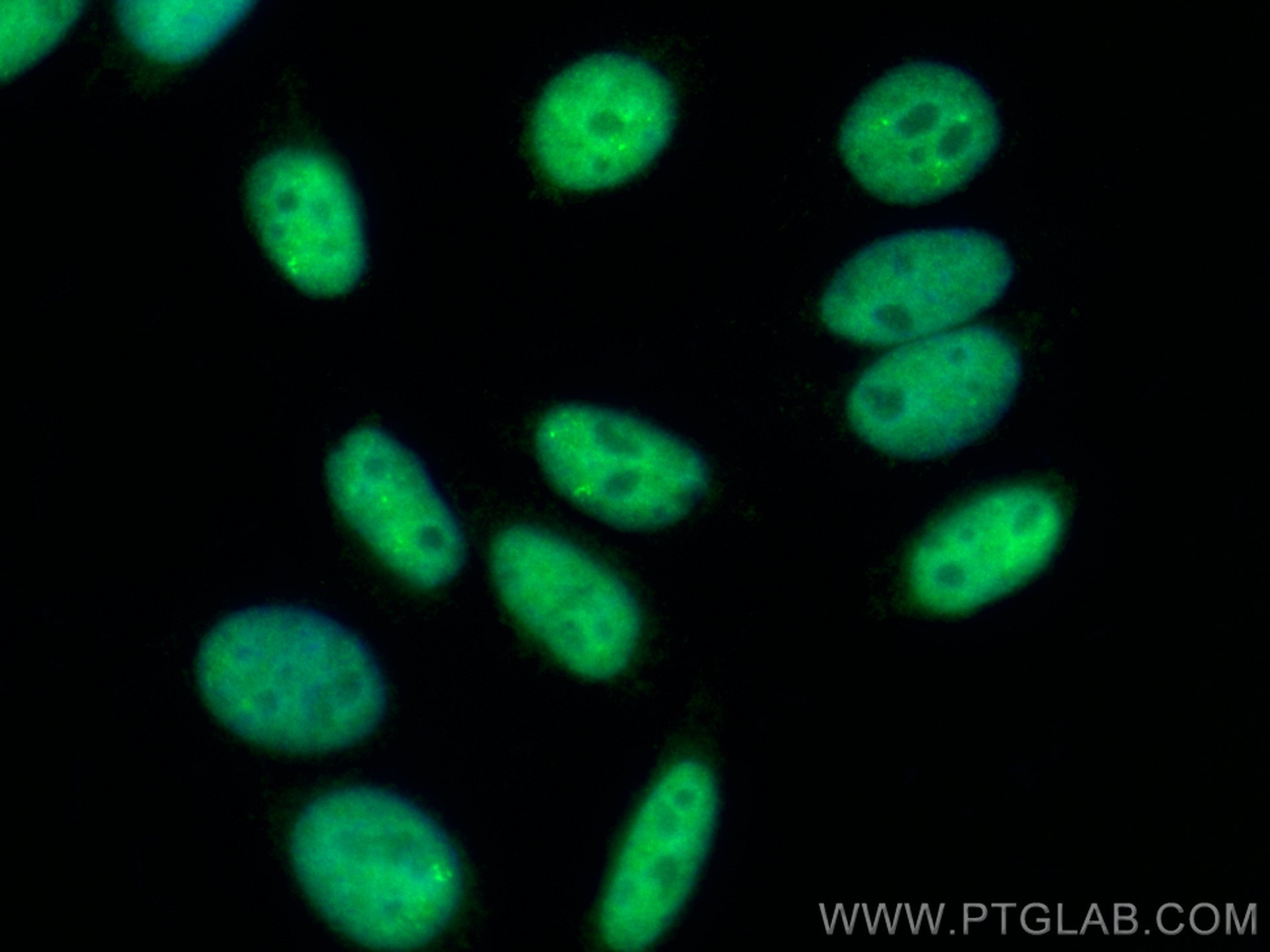 IF Staining of HepG2 using CL488-67685