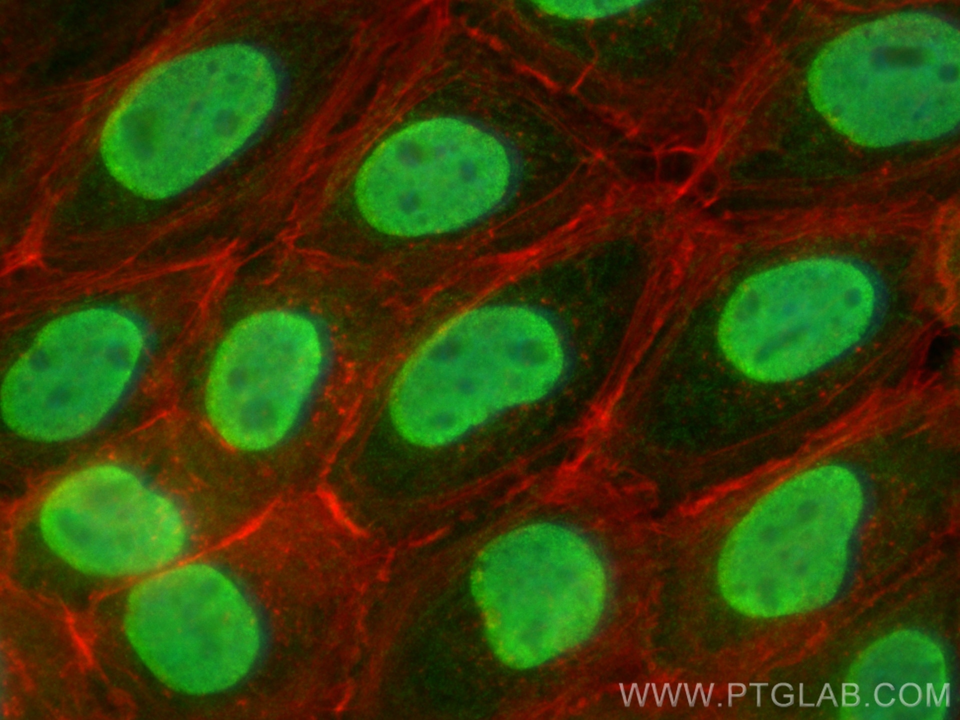 Immunofluorescence (IF) / fluorescent staining of A431 cells using NF90/ILF3 Polyclonal antibody (19887-1-AP)