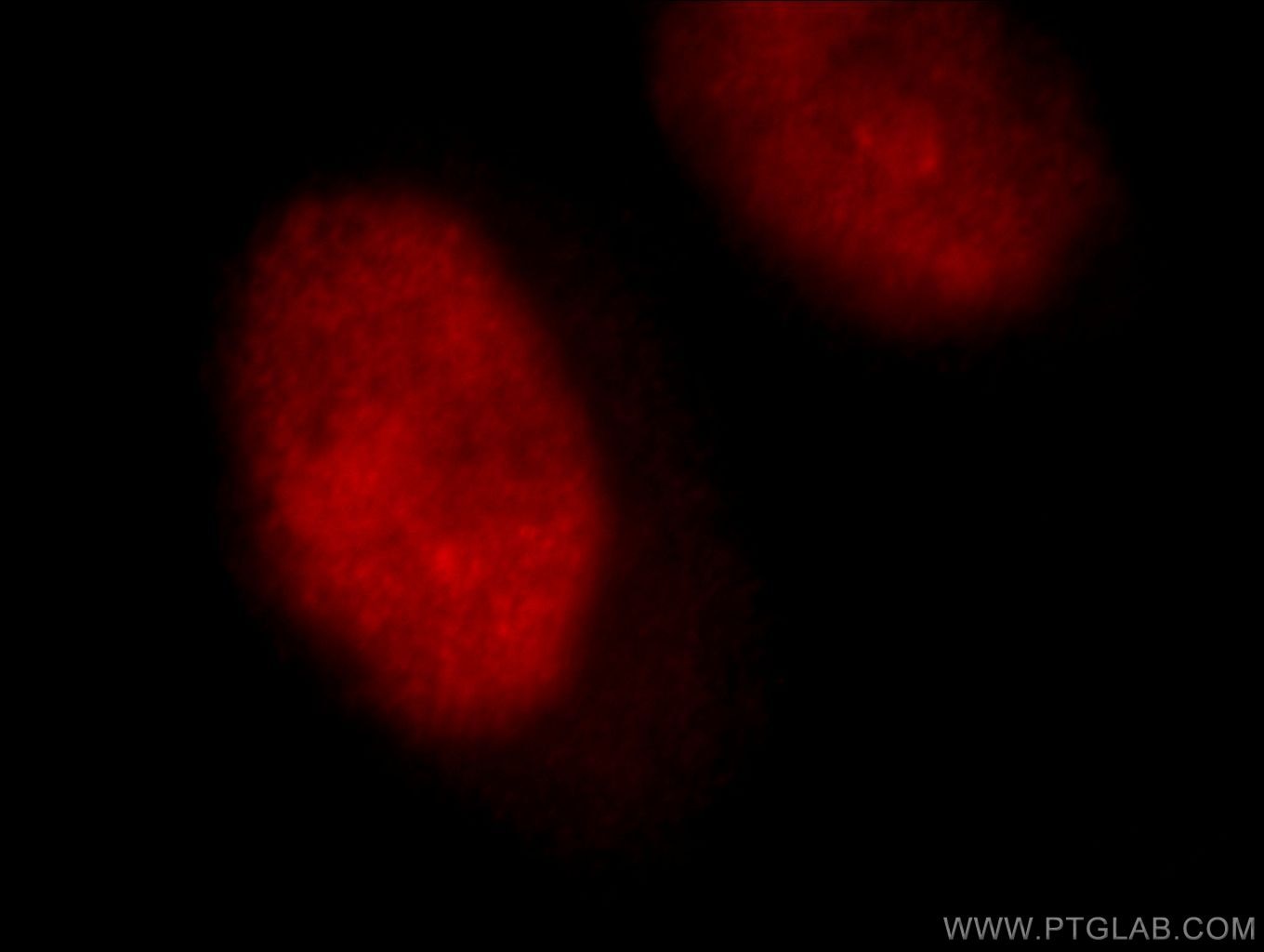 Immunofluorescence (IF) / fluorescent staining of HeLa cells using NF90/ILF3 Polyclonal antibody (19887-1-AP)