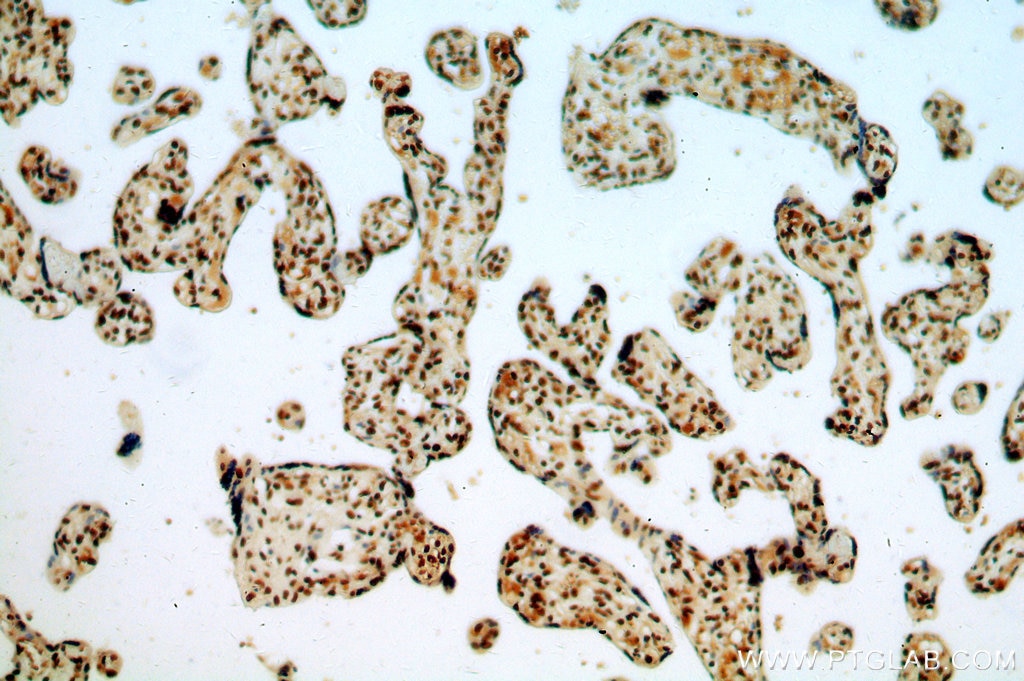 Immunohistochemistry (IHC) staining of human placenta tissue using NF90/ILF3 Polyclonal antibody (19887-1-AP)