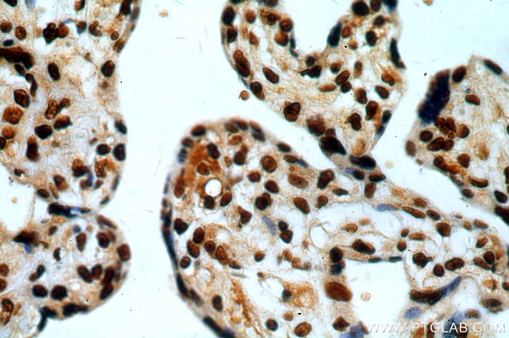 Immunohistochemistry (IHC) staining of human placenta tissue using NF90/ILF3 Polyclonal antibody (19887-1-AP)