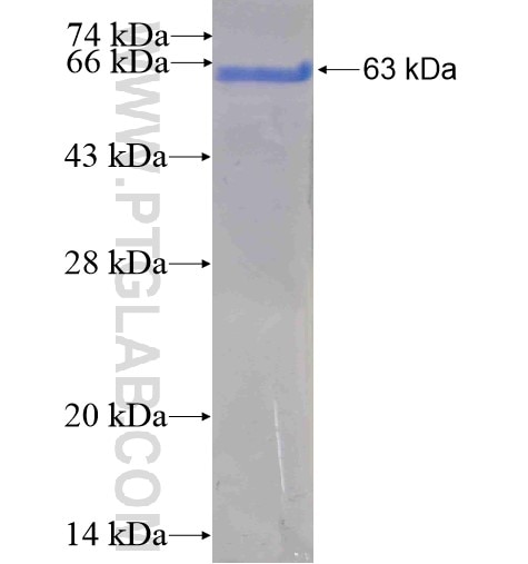 NF90,ILF3 fusion protein Ag13707 SDS-PAGE