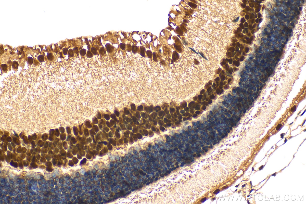 Immunohistochemistry (IHC) staining of mouse eye tissue using NF90/ILF3 Monoclonal antibody (68213-1-Ig)