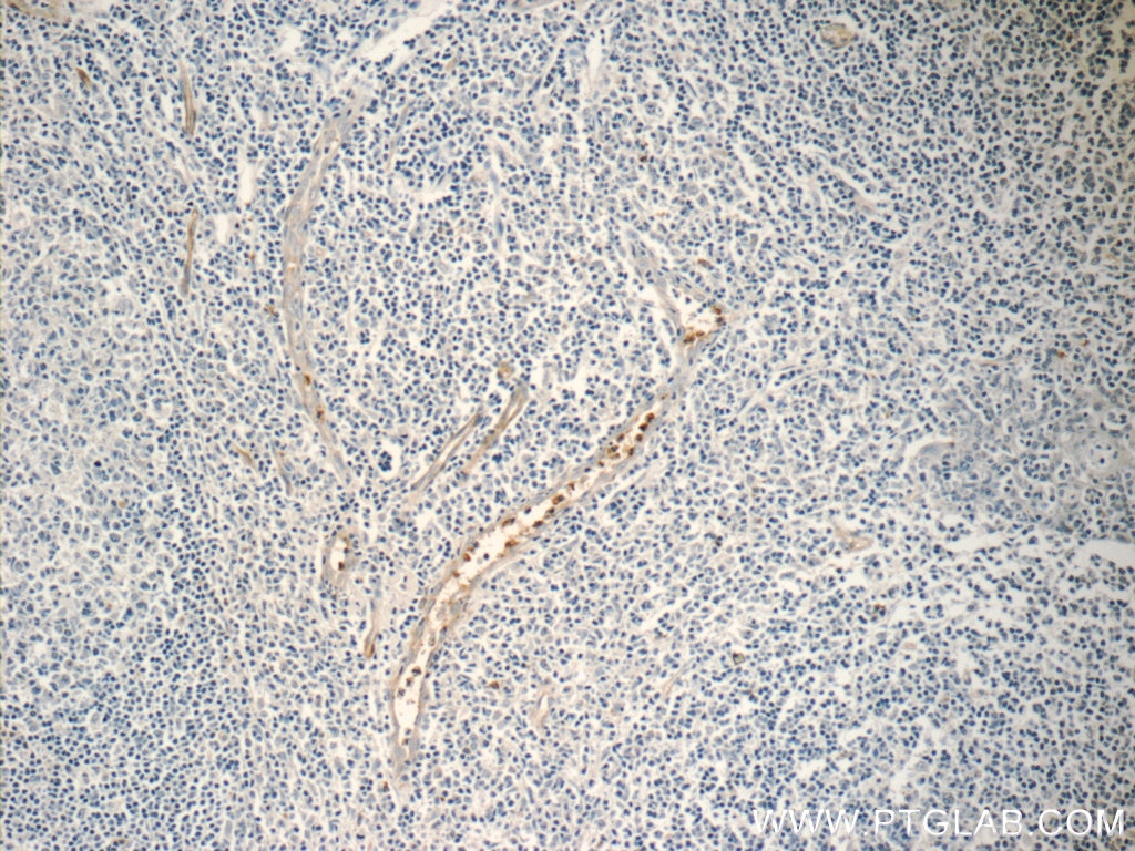 Immunohistochemistry (IHC) staining of human tonsillitis tissue using NFAM1 Polyclonal antibody (14310-1-AP)
