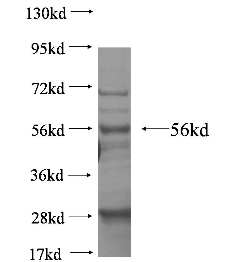 NFAM1 fusion protein Ag5359 SDS-PAGE