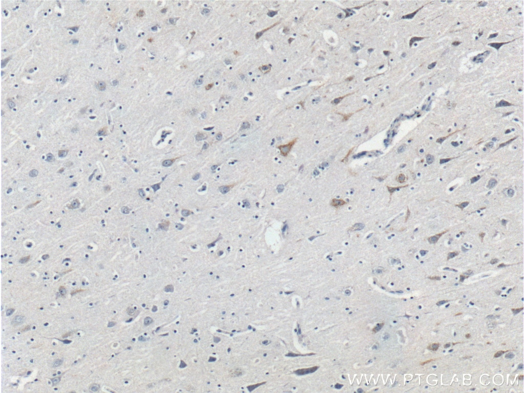 IHC staining of human brain using 26351-1-AP