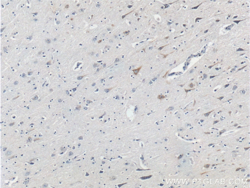 Immunohistochemistry (IHC) staining of human brain tissue using Neurofascin Polyclonal antibody (26351-1-AP)