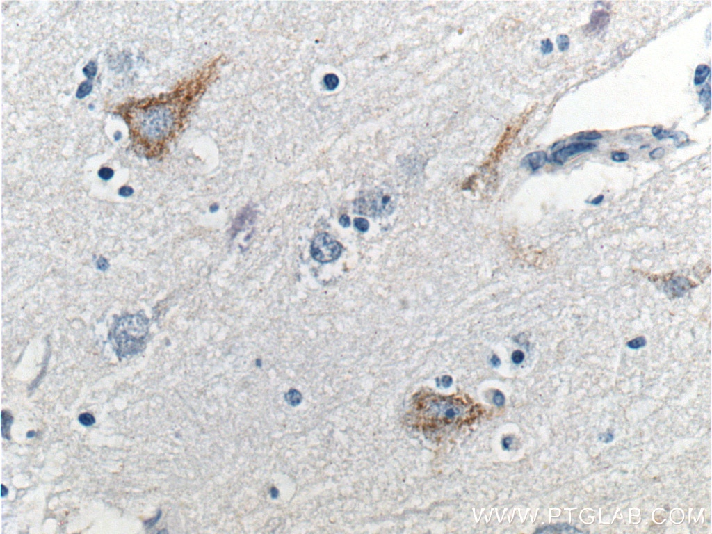 Immunohistochemistry (IHC) staining of human brain tissue using Neurofascin Polyclonal antibody (26351-1-AP)