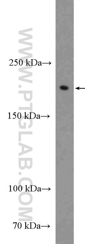 Western Blot (WB) analysis of rat brain tissue using Neurofascin Polyclonal antibody (26351-1-AP)