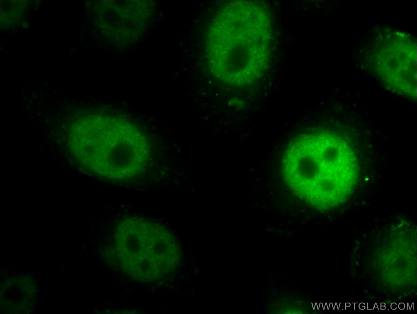 Immunofluorescence (IF) / fluorescent staining of HepG2 cells using NFAT5 Polyclonal antibody (21713-1-AP)
