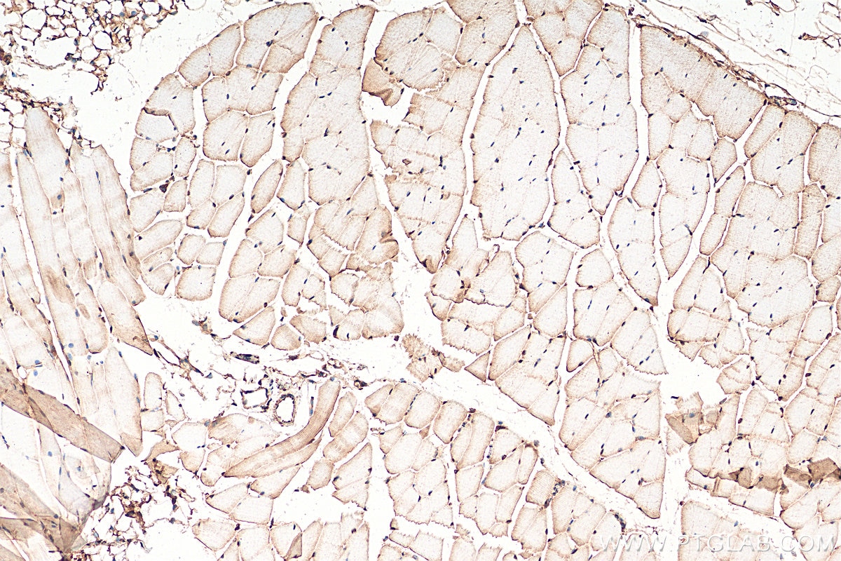 Immunohistochemistry (IHC) staining of mouse skeletal muscle tissue using NFAT5 Polyclonal antibody (21713-1-AP)