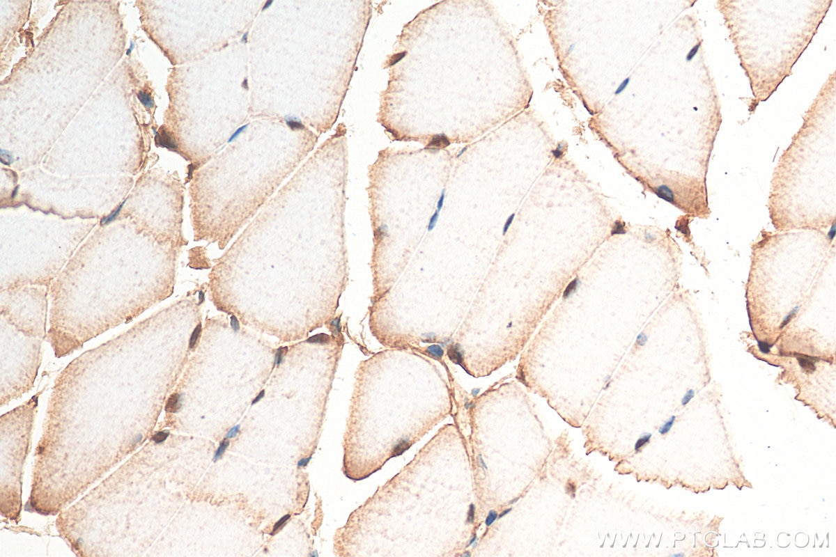 Immunohistochemistry (IHC) staining of mouse skeletal muscle tissue using NFAT5 Polyclonal antibody (21713-1-AP)