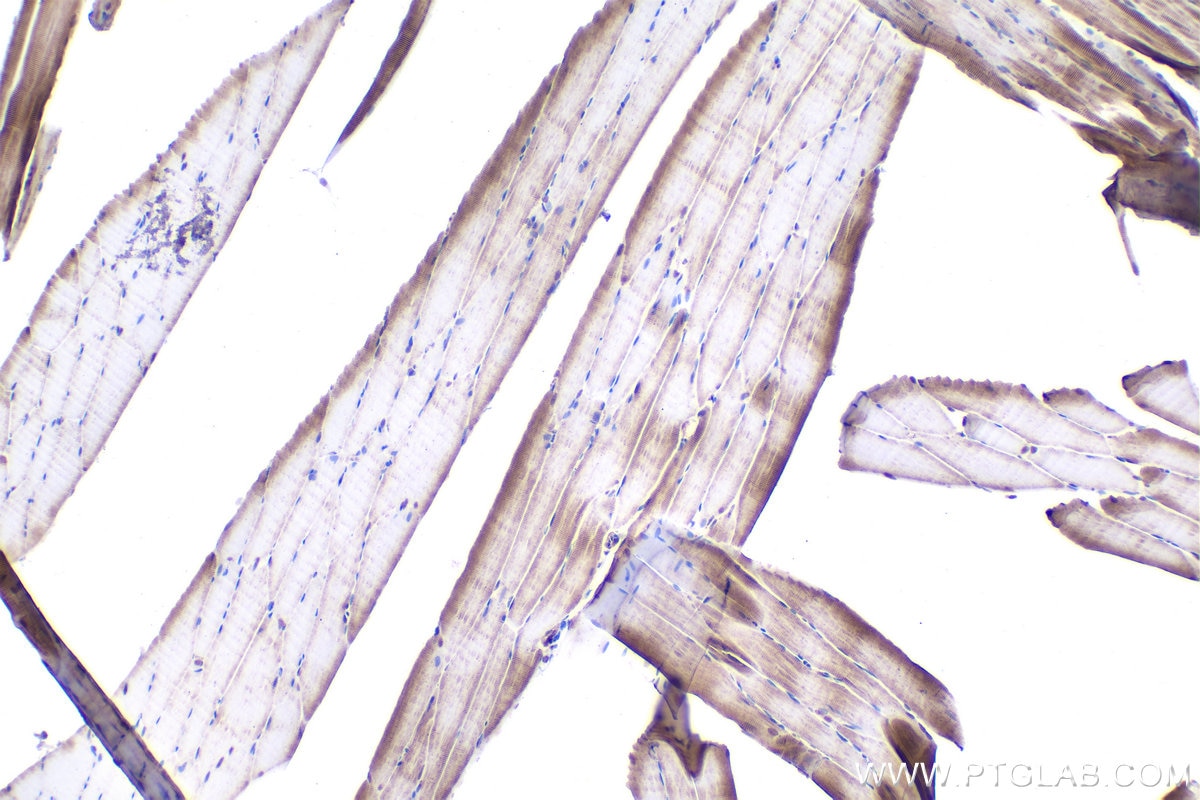 Immunohistochemistry (IHC) staining of rat skeletal muscle tissue using NFAT5 Polyclonal antibody (21713-1-AP)