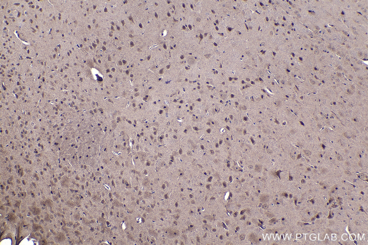 Immunohistochemistry (IHC) staining of mouse brain tissue using NFAT5 Polyclonal antibody (21713-1-AP)
