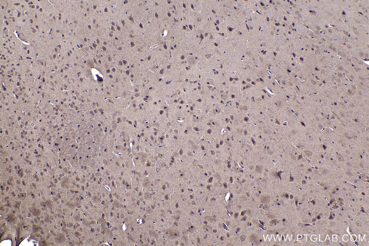 IHC staining of mouse brain using 21713-1-AP