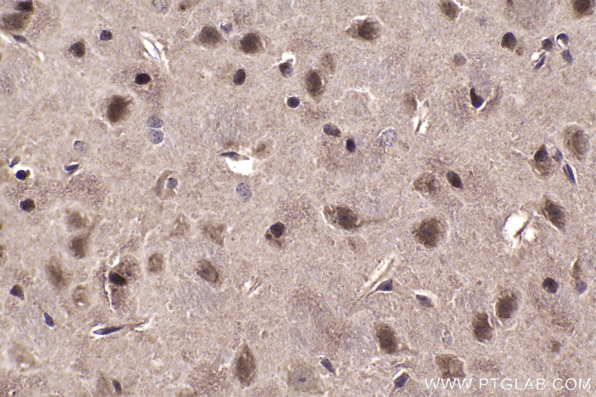 IHC staining of mouse brain using 21713-1-AP