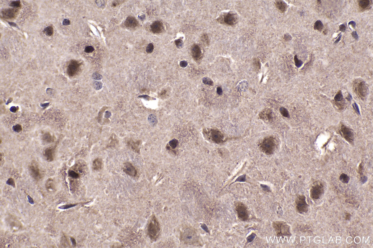 Immunohistochemistry (IHC) staining of mouse brain tissue using NFAT5 Polyclonal antibody (21713-1-AP)