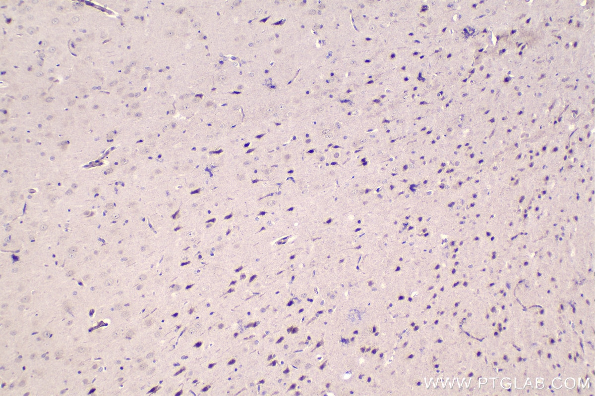 IHC staining of rat brain using 21713-1-AP