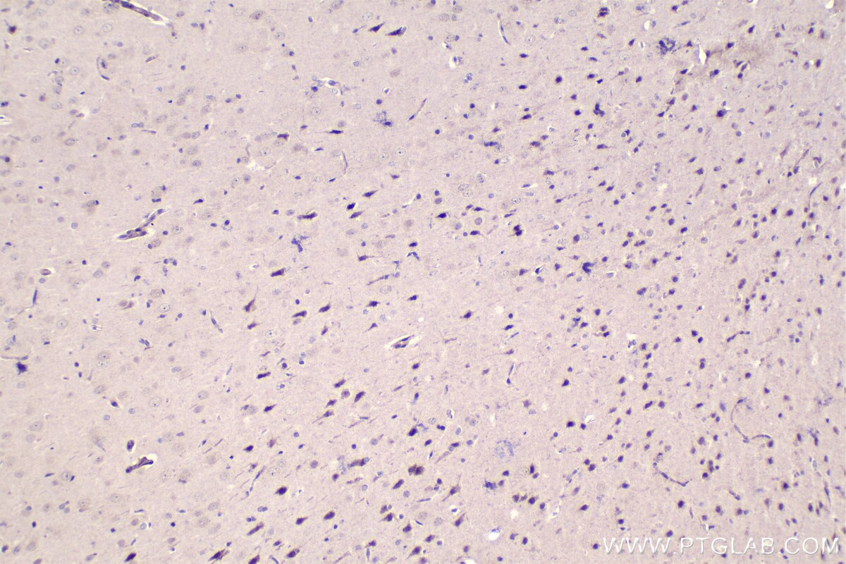 Immunohistochemistry (IHC) staining of rat brain tissue using NFAT5 Polyclonal antibody (21713-1-AP)