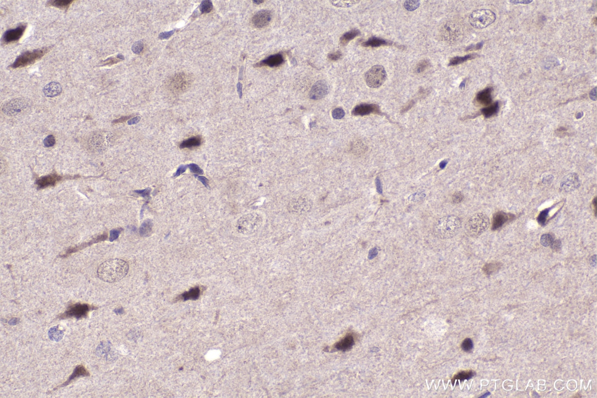 Immunohistochemistry (IHC) staining of rat brain tissue using NFAT5 Polyclonal antibody (21713-1-AP)