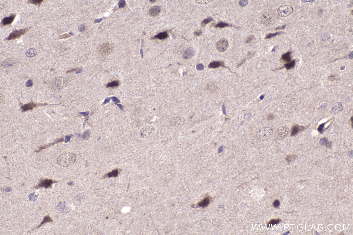 IHC staining of rat brain using 21713-1-AP