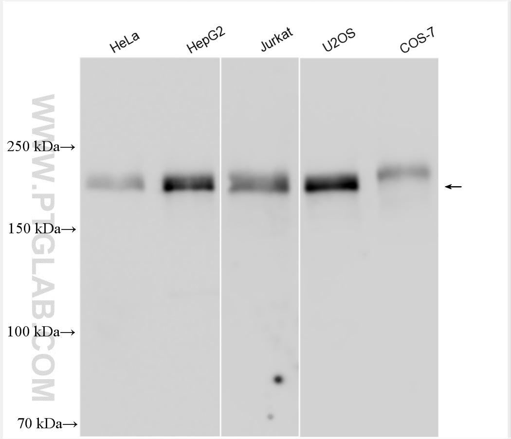 Western Blot (WB) analysis of various lysates using NFAT5 Polyclonal antibody (21713-1-AP)