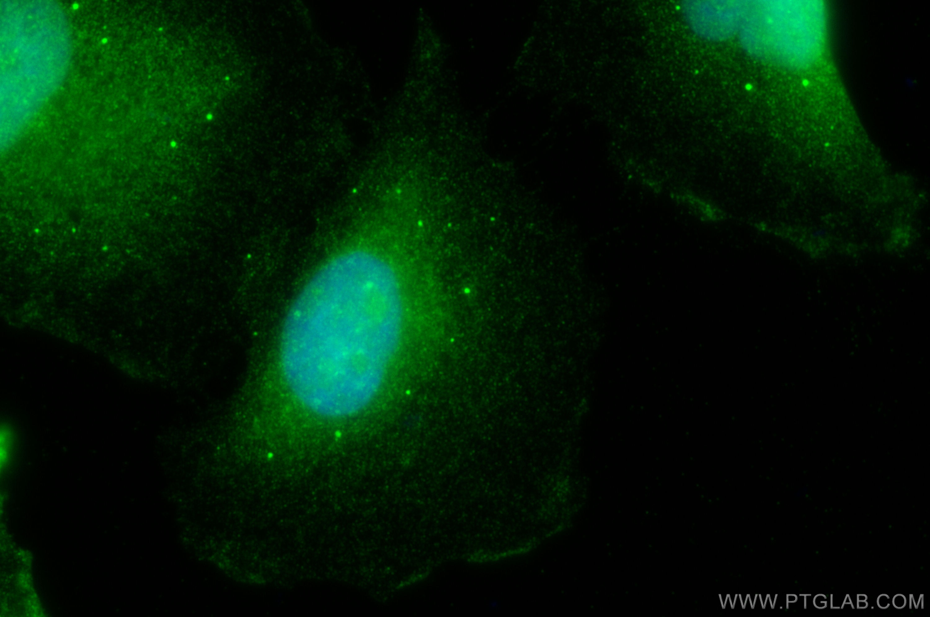 Immunofluorescence (IF) / fluorescent staining of U-251 cells using NFATC1 Polyclonal antibody (30114-1-AP)