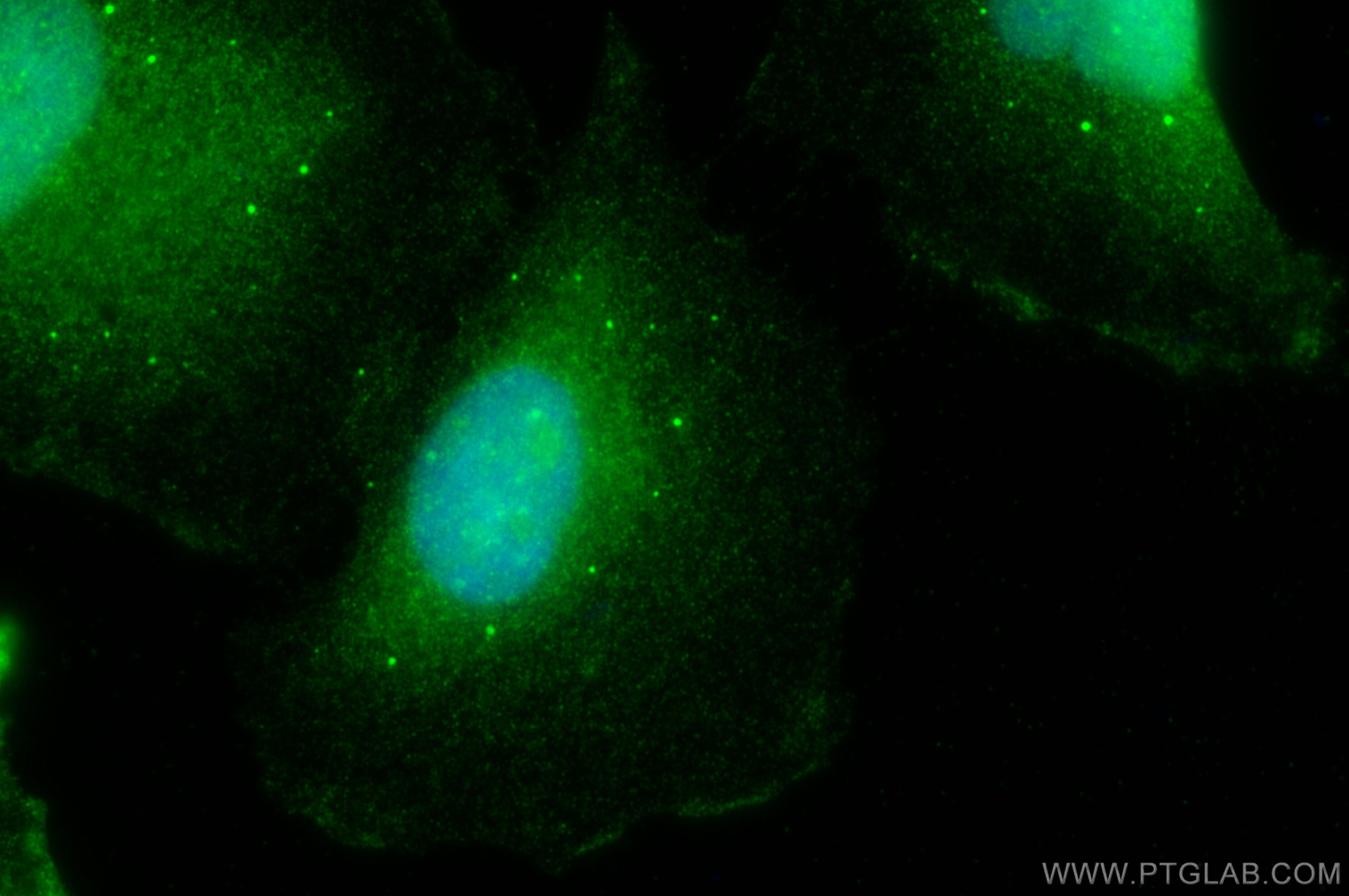 IF Staining of U-251 using 30114-1-AP