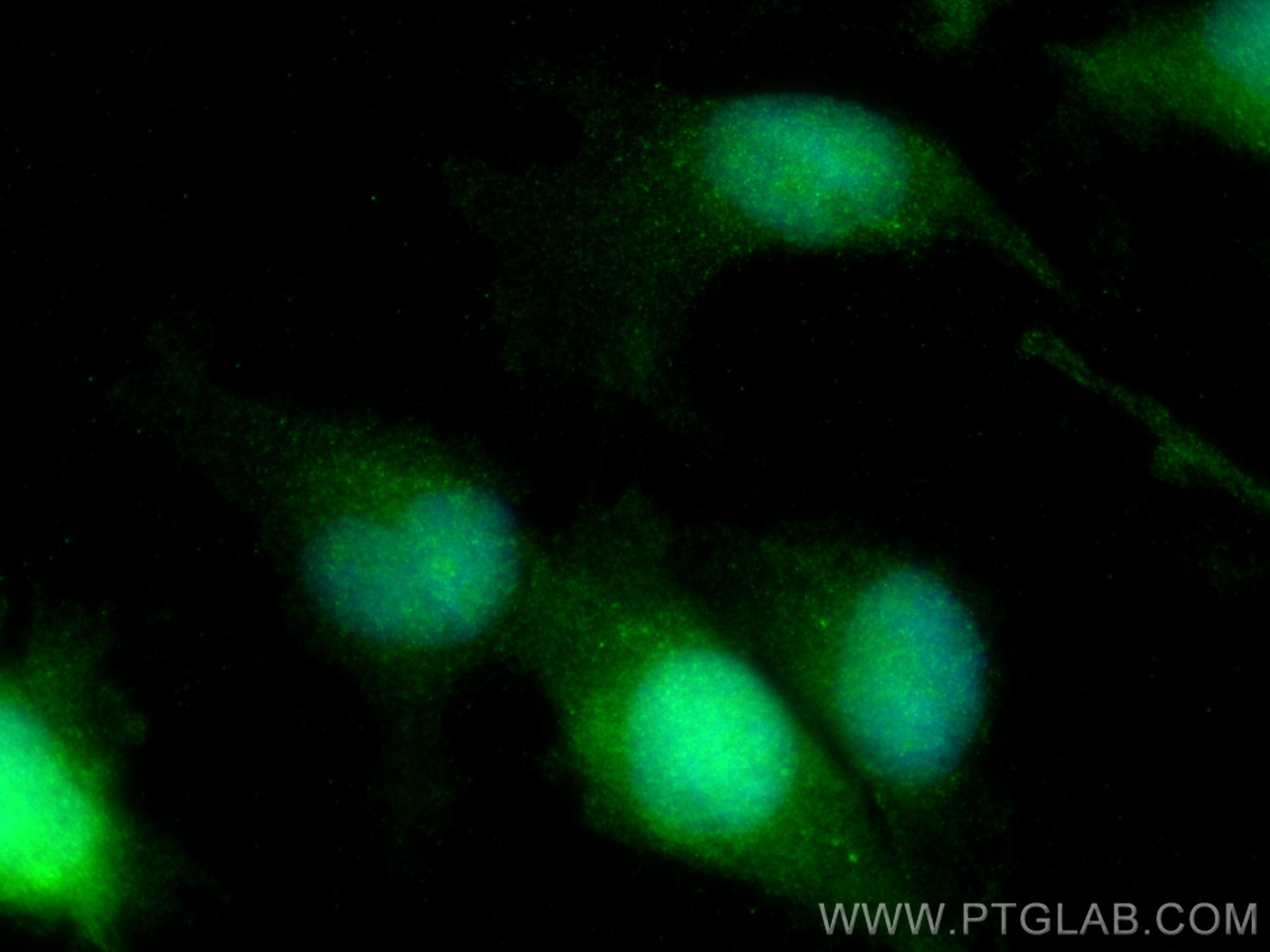 Immunofluorescence (IF) / fluorescent staining of U-251 cells using NFATC2 Polyclonal antibody (22023-1-AP)