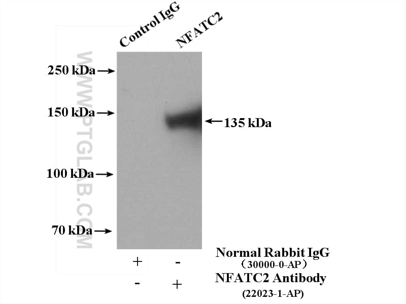 Immunoprecipitation (IP) experiment of Jurkat cells using NFATC2 Polyclonal antibody (22023-1-AP)